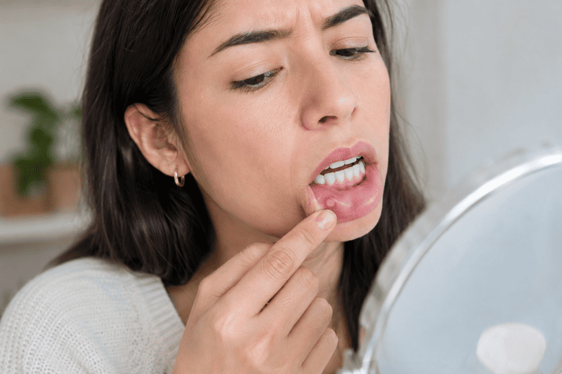 Conoce las causas de las aftas recurrentes, cómo diferenciarlas del herpes labial, qué cuidados ayudan y cuándo es necesario consultar a un profesional.